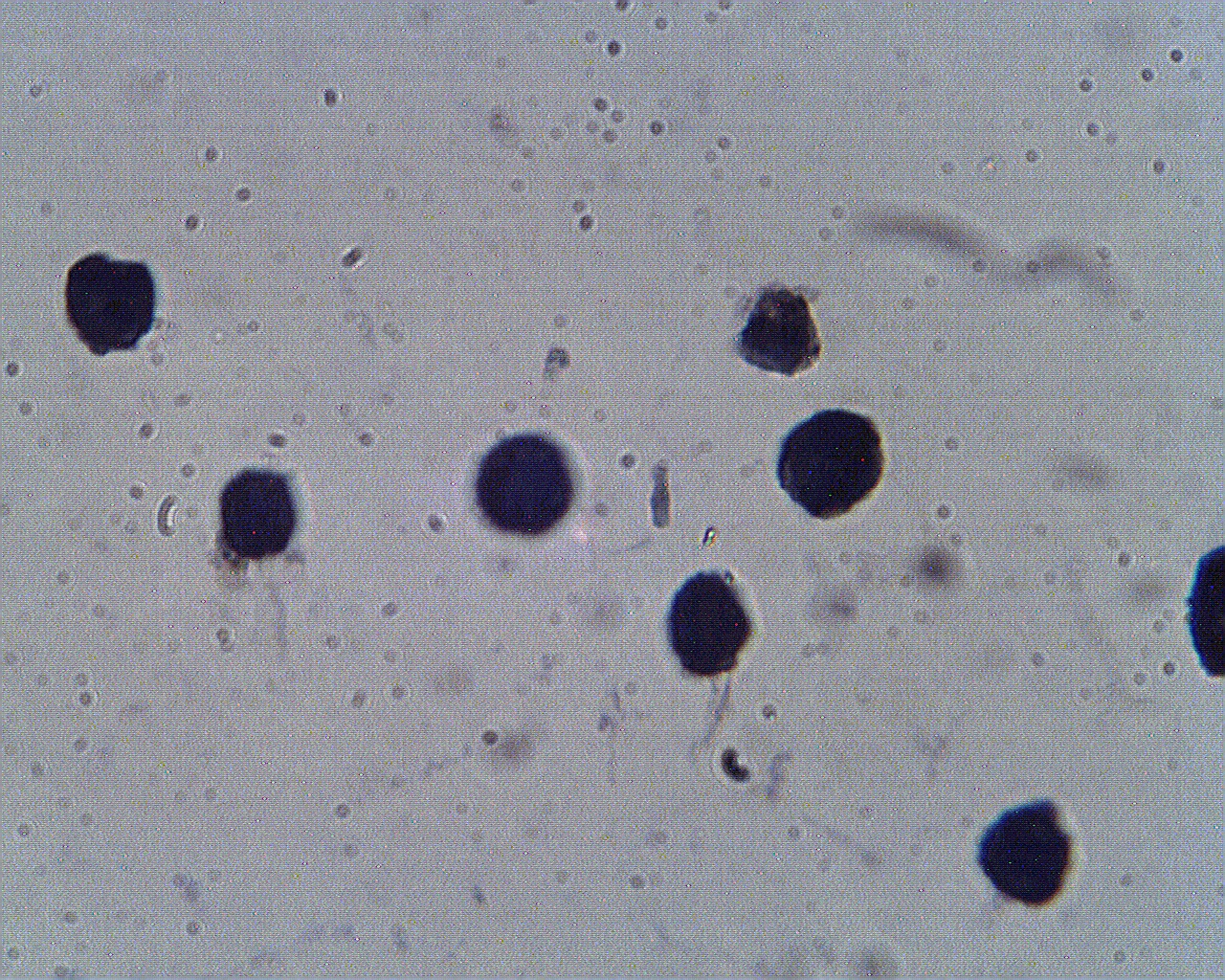 Staining of Hep G2 cells with PCSK9 antibody (Cat. No. X2740P) at 2 µg/ml.
